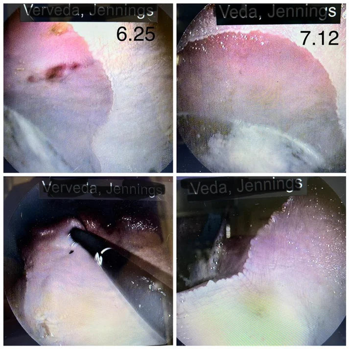 VETZONE THREE/THIRTY-ULCER TREATMENT-32 OZ